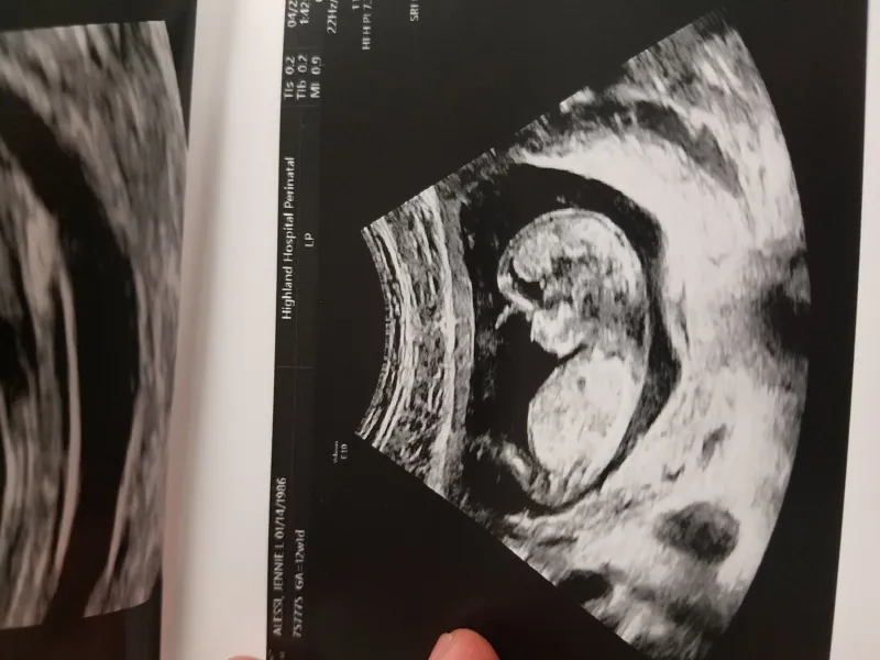 We Did A Thing We Did A Thing
