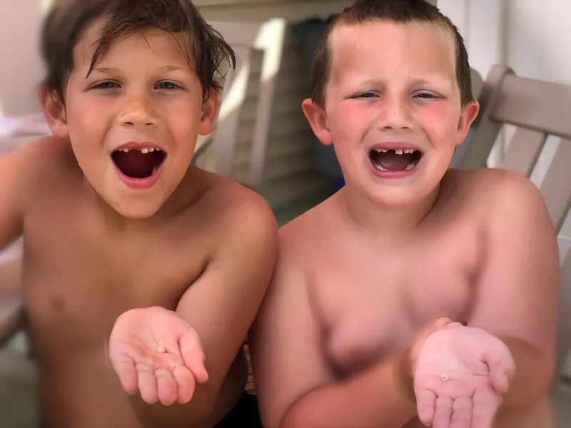 Cousins lose same tooth minutes apart!! Cousins lose same tooth minutes apart!!