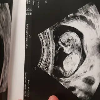 We Did A Thing We Did A Thing